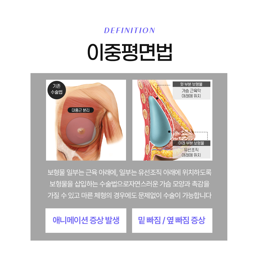 애니메이션 현상 고민이라면? 삼중평면법으로 교정하기 관련 이미지 4