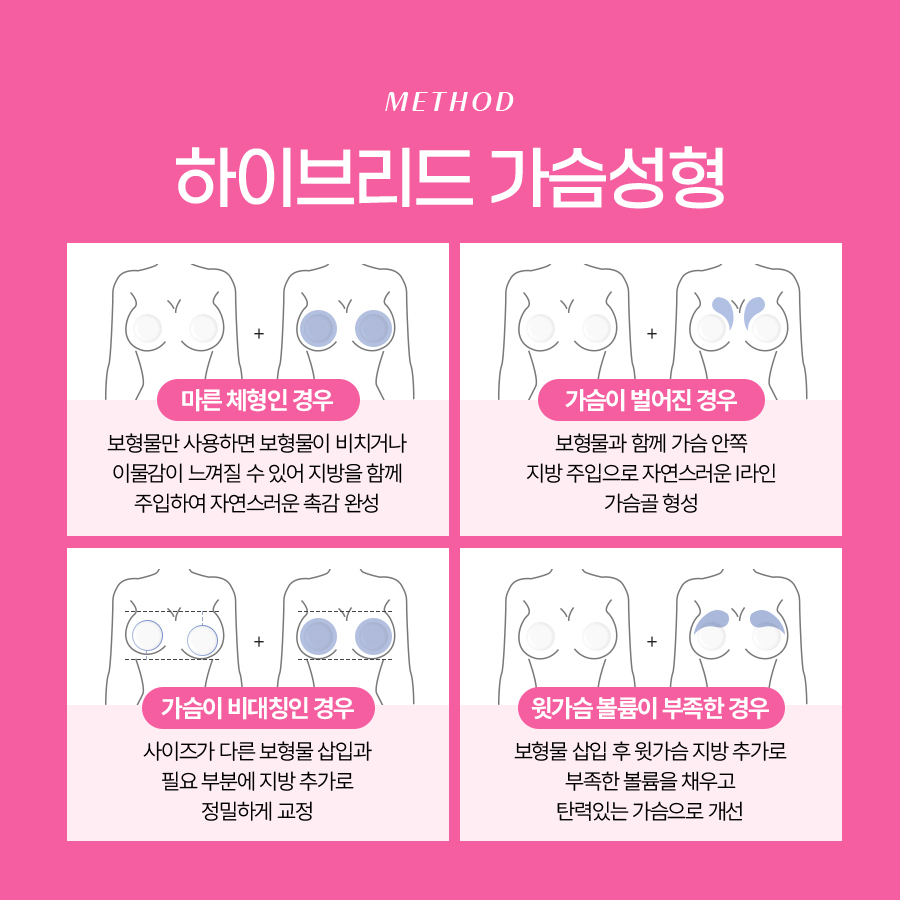 지방이식가슴성형 효과 높이는 하이브리드 수술법 관련 이미지 5