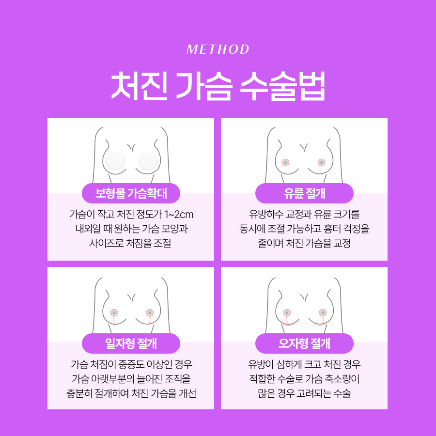 유방하수교정수술 고려 전 가슴 변화 원리 정리 관련 이미지 6
