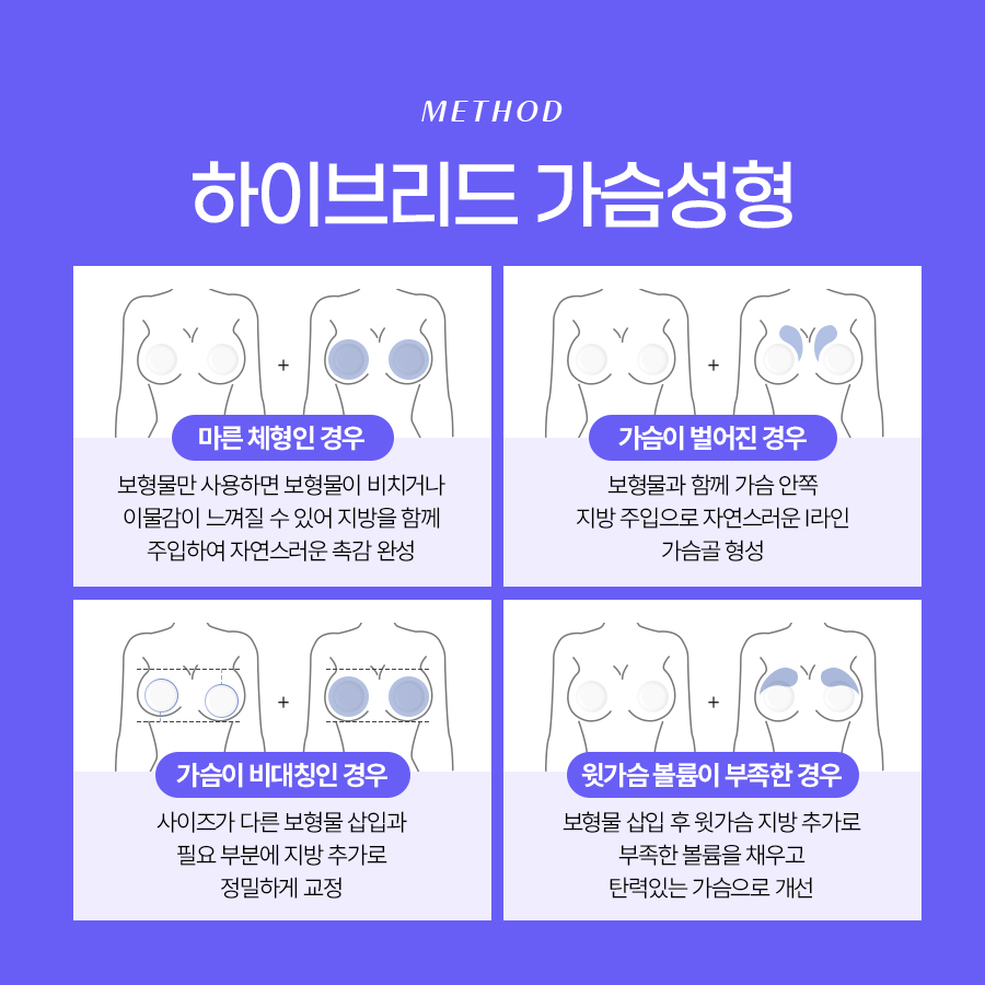 하이브리드가슴성형 자연스러움과 볼륨을 모두 잡는 선택 관련 이미지 5
