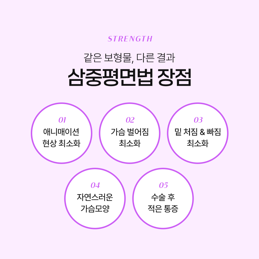 가슴성형잘하는병원 평면별 수술 접근 방식 관련 이미지 5