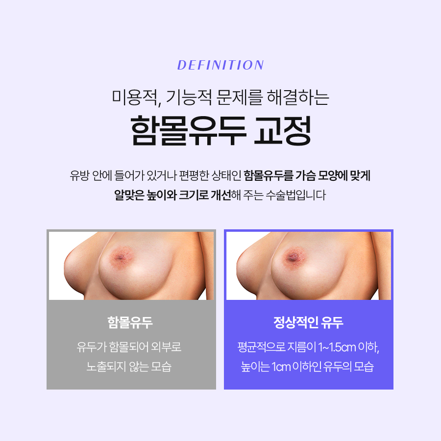 함몰유두교정술 적합한 수술방법은? 관련 이미지 3