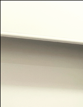 Recommended Breast Revision Surgery Clinics: Why the Triple-Plane Technique Is Drawing Attention image 10