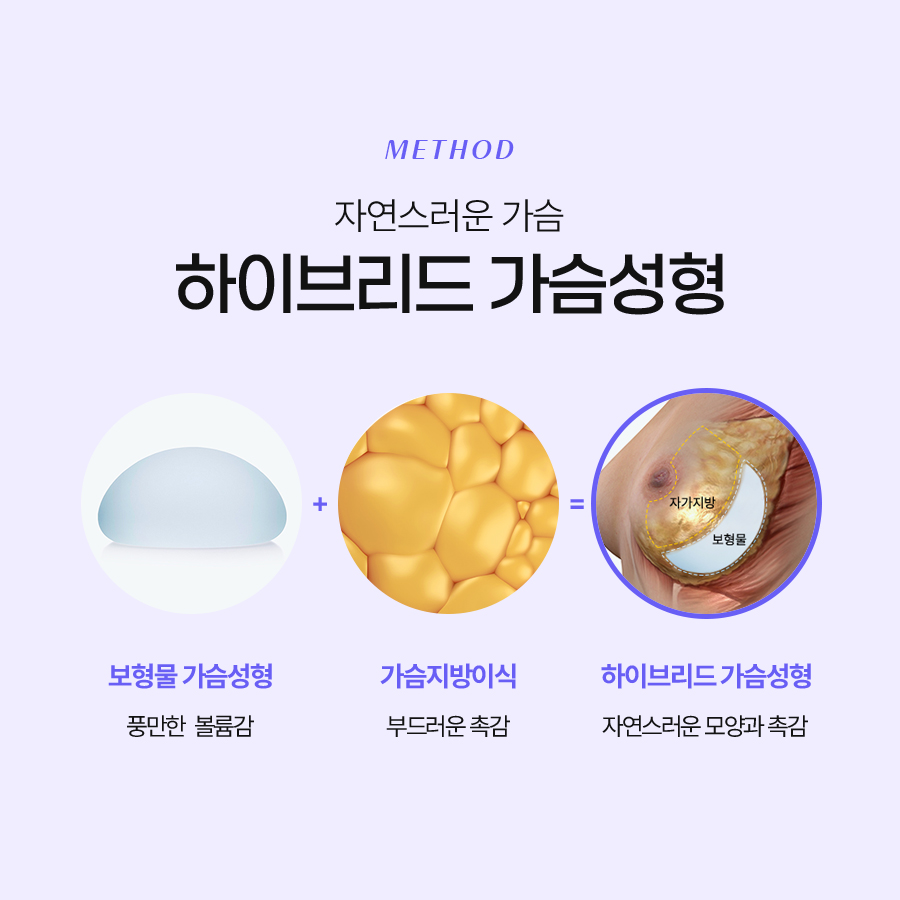 하이브리드가슴성형 자연스러움과 볼륨감을 동시에! 관련 이미지 5