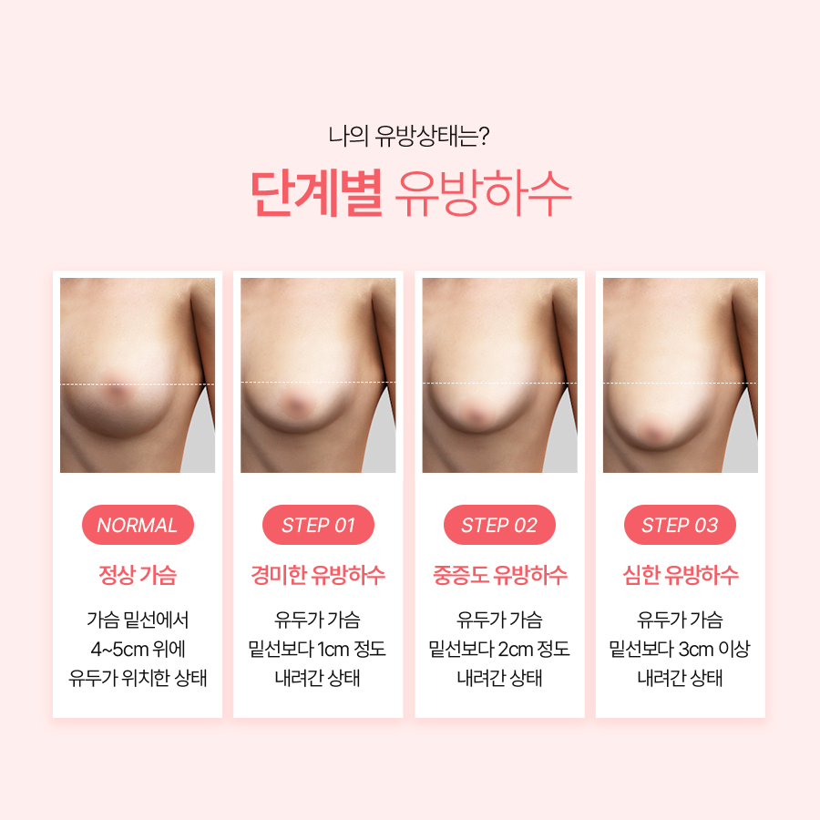 유방하수수술 후기 부유방까지 함께 본 이유 관련 이미지 4