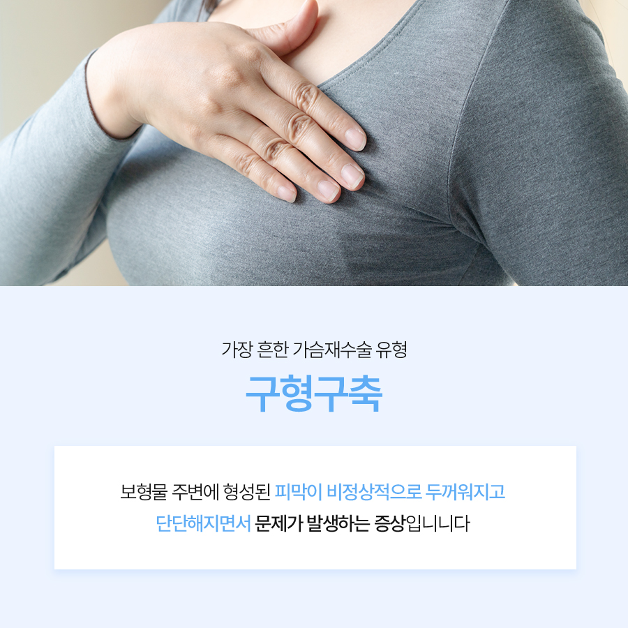 가슴성형겨절후기 재수술 겨드랑이 절개 선택 기준 관련 이미지 3