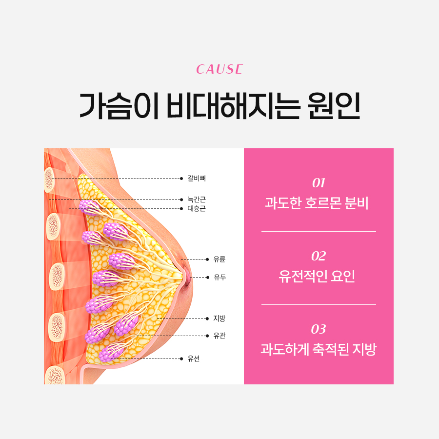 Breast Reduction Surgery for the Treatment of Macromastia image 3