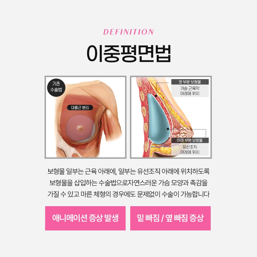 삼중평면법 자연스러운 결과를 원하신다면 관련 이미지 3