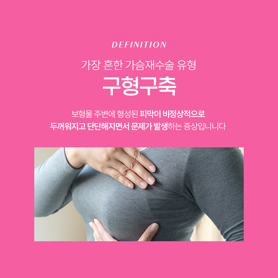 겨드랑이절개재수술 전에 꼭 알아야 할 것들 관련 이미지 3
