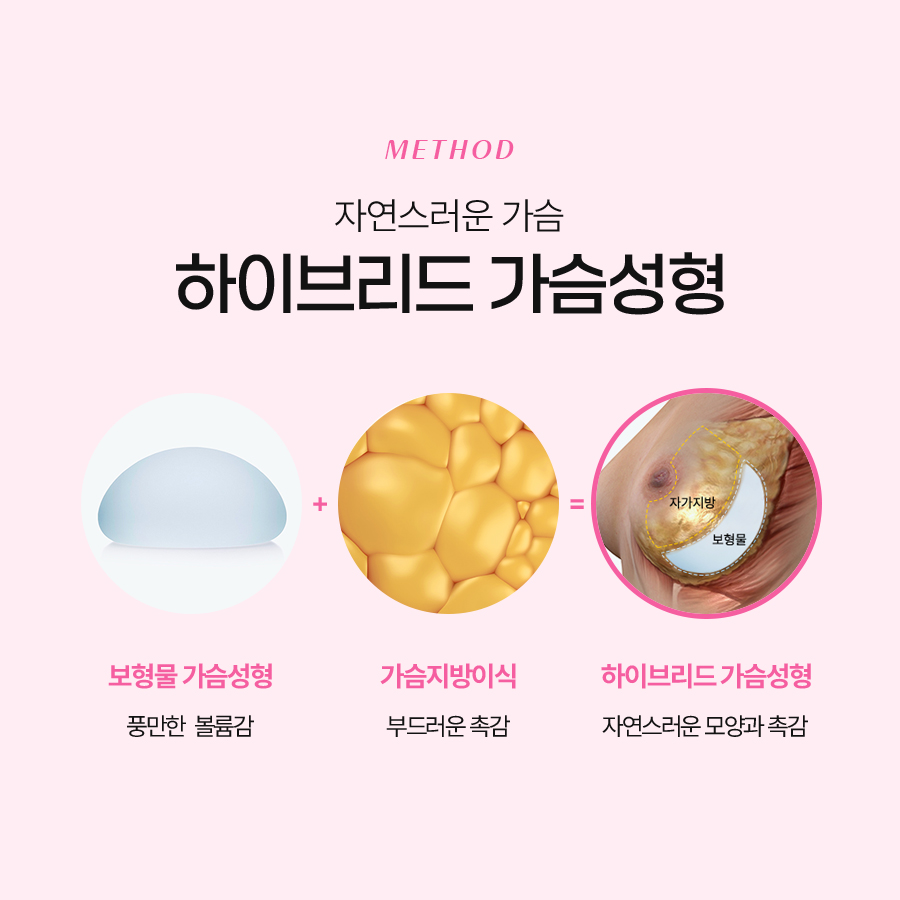 지방이식가슴성형 자연스러움을 선택하다 관련 이미지 5