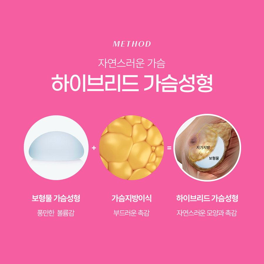 지방이식가슴성형 효과 높이는 하이브리드 수술법 관련 이미지 4