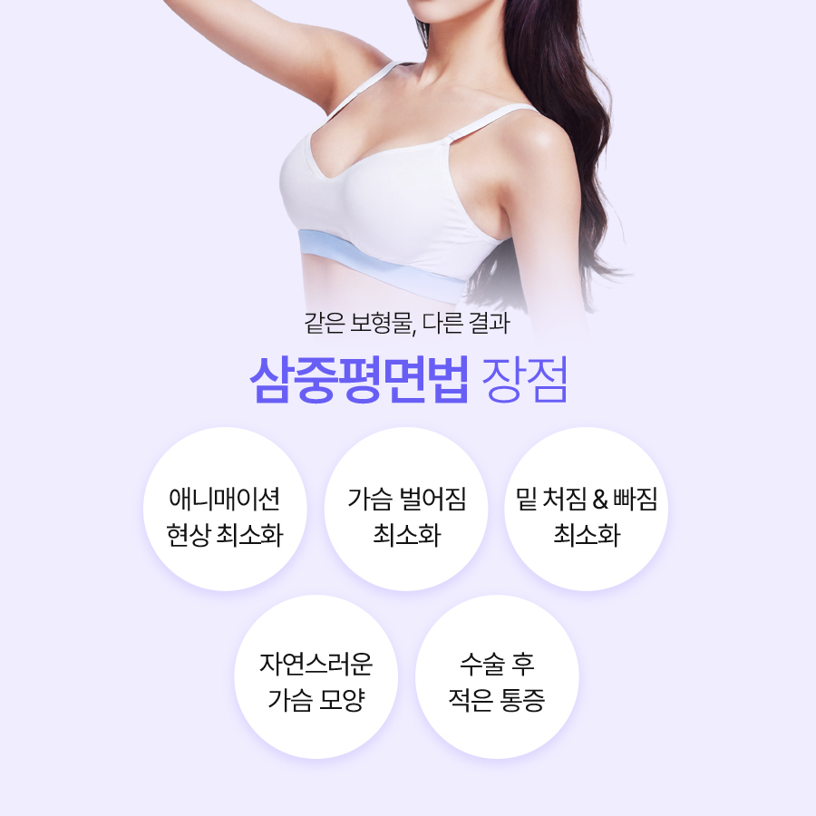 가슴수술잘하는병원 자연스러운 움직임을 고려한 가슴수술 방식 비교 관련 이미지 5