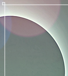 Why Planning Must Be Different for Breast Revision Surgery Due to Capsular Contracture image 10