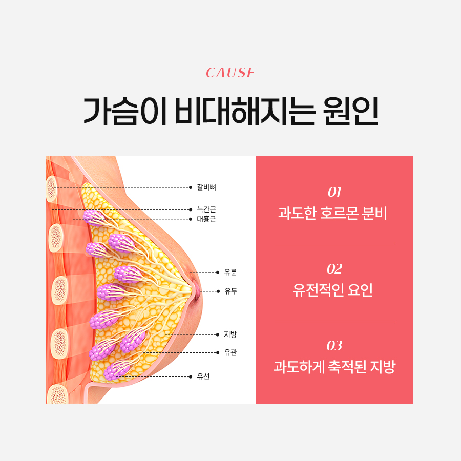 처진가슴성형 전 꼭 알아야 할 가슴축소술의 모든 것 관련 이미지 3