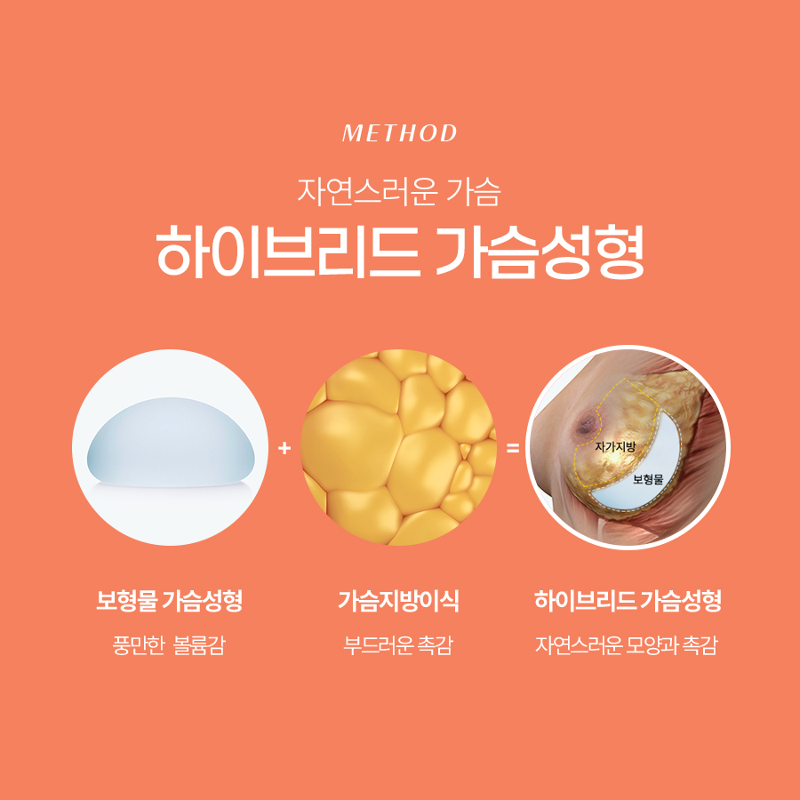 지방이식가슴확대술 기반 하이브리드 수술 관련 이미지 4