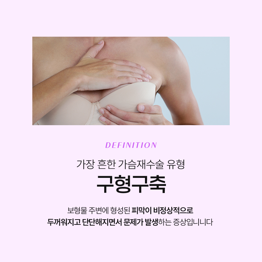 Why Axillary Scar from Breast Augmentation Is Considered in Breast Revision Surgery image 3