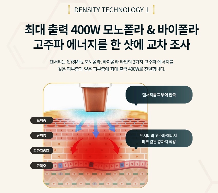 팔자주름시술 덴서티 자연스러운 볼륨감을 관련 이미지 2