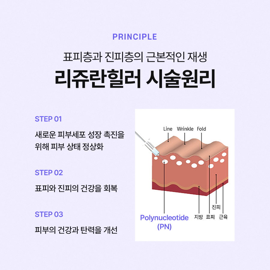 Effective for Skin Improvement: Rejuran Healer image 4