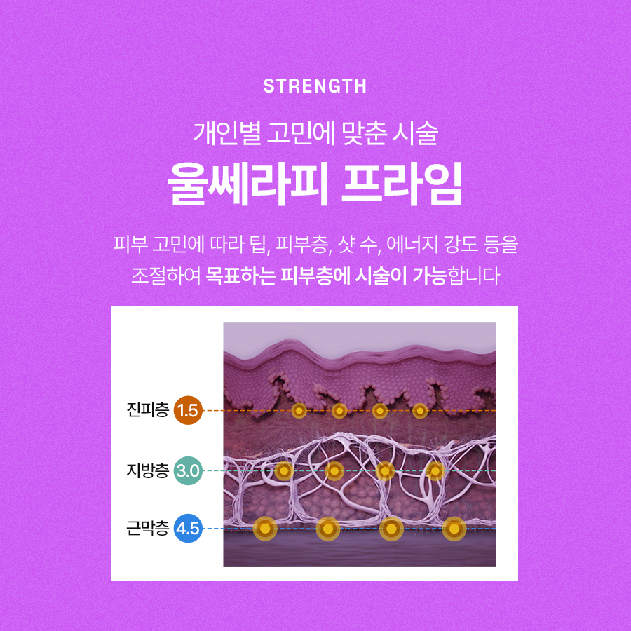 울쎄라피프라임 리프팅 효과 확인하는 관련 이미지 3