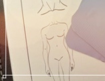 리팟레이저 얼굴흑자 치료하고 싶다면 관련 이미지 16