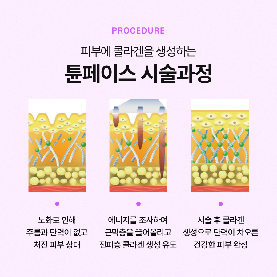 Effective Anti-Aging Care with TuneFace image 5