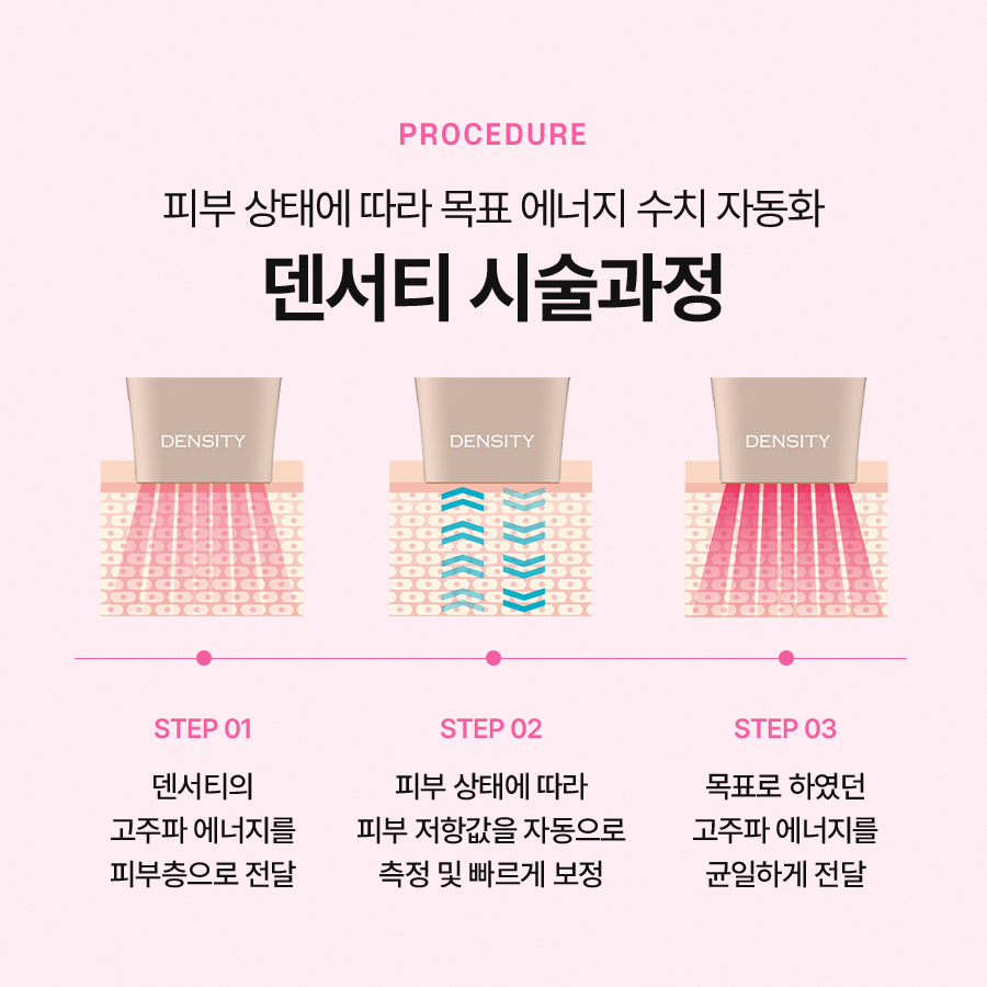 덴서티하이 시술 효과 및 통증 확인하여 관련 이미지 4