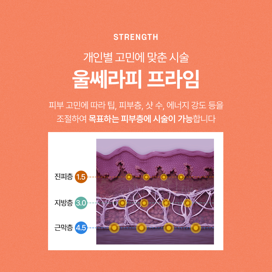 울쎄라프라임 리프팅 효과와 적용 부위에 대해 관련 이미지 4