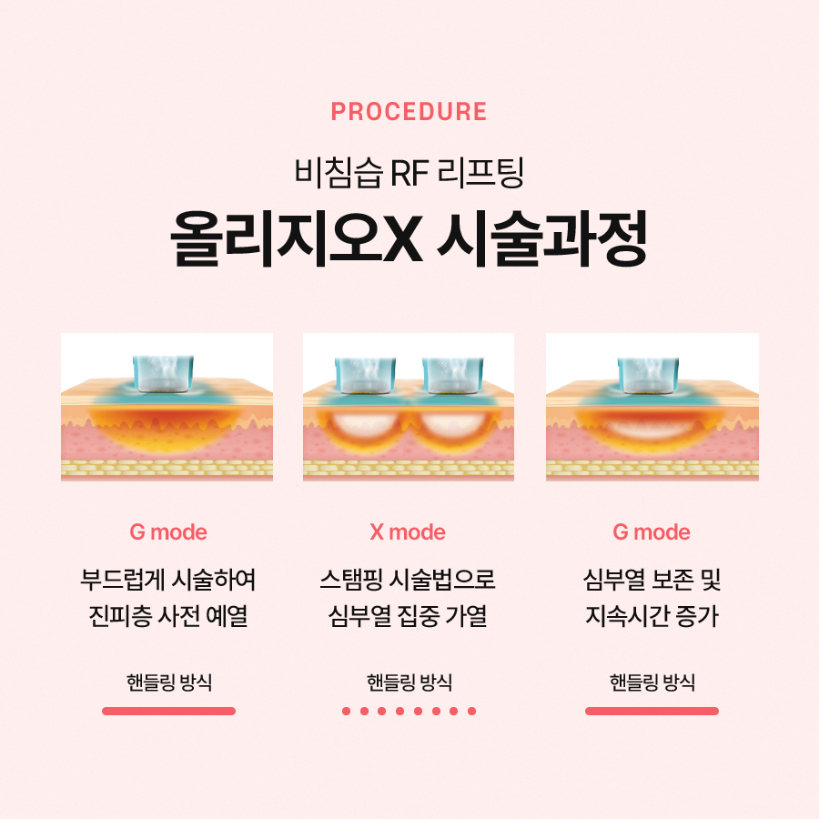 올리지오x 리프팅 효과 찾아보면 관련 이미지 4