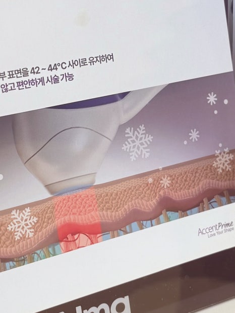 써마지FLX 리프팅 효과 알아보면 관련 이미지 23