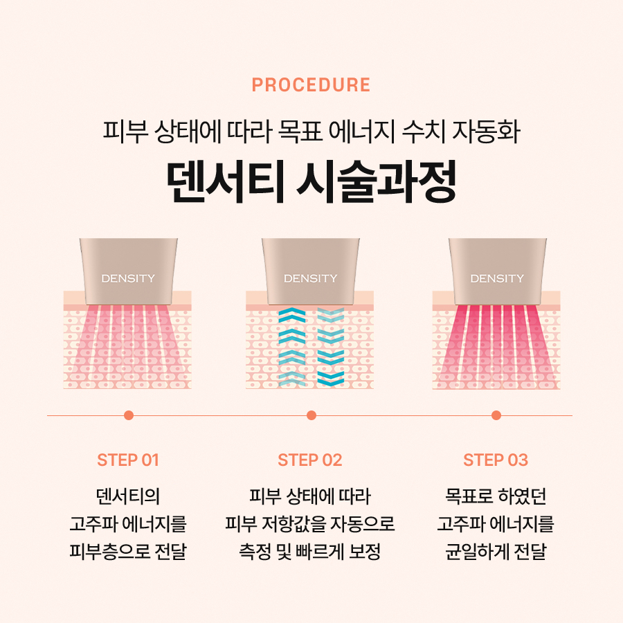 If You Want to Experience the Lifting Effect of Density High image 4