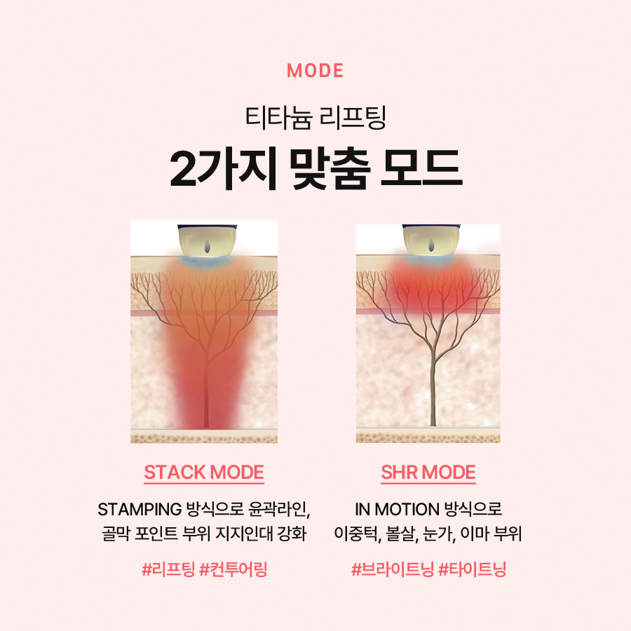 티타늄리프팅 원리와 효과가 궁금하신가요? 관련 이미지 3