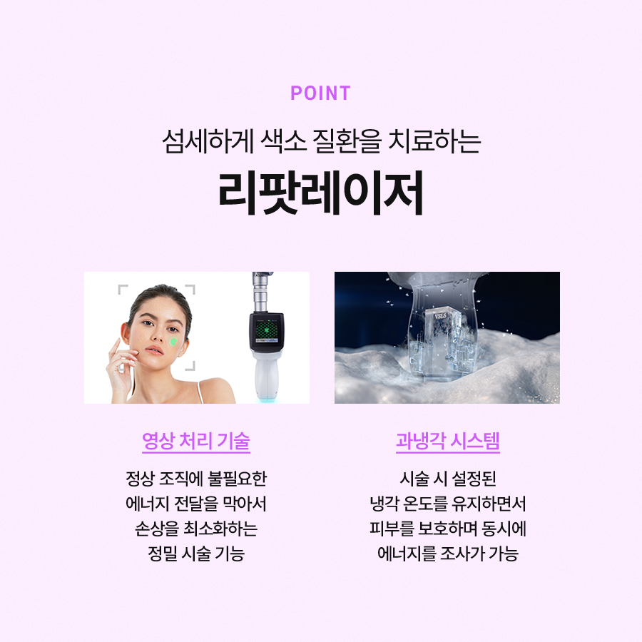 리팟레이저 효과와 적용 대상이 궁금하다면 관련 이미지 4