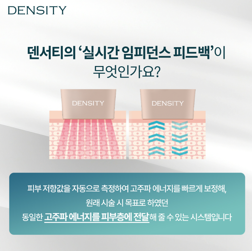 얼굴주름리프팅 비용, 추천대상 덴서티를 알아본다면 관련 이미지 3