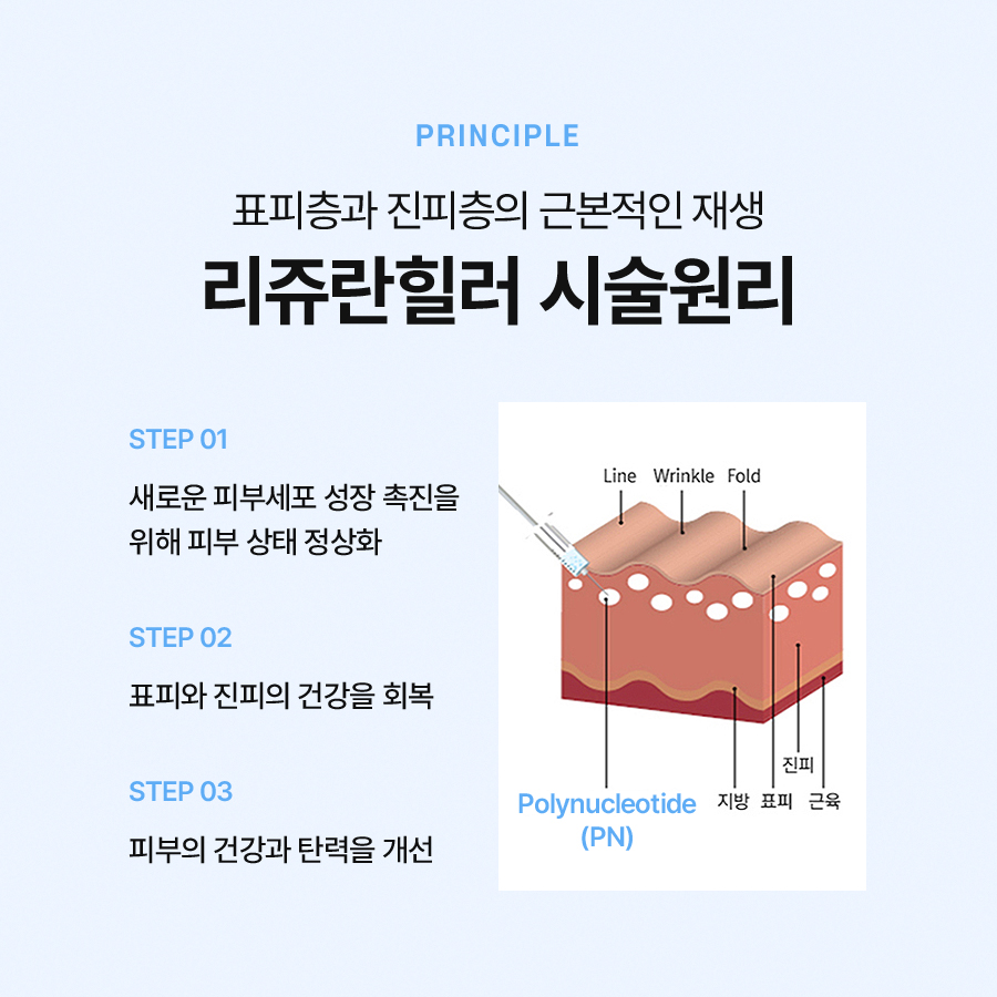 How Long Does Rejuran Healer Last and How Often Should the Procedure Be Done? image 4