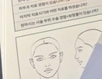 The Principles and Effects of TuneFace Lifting Treatment image 22