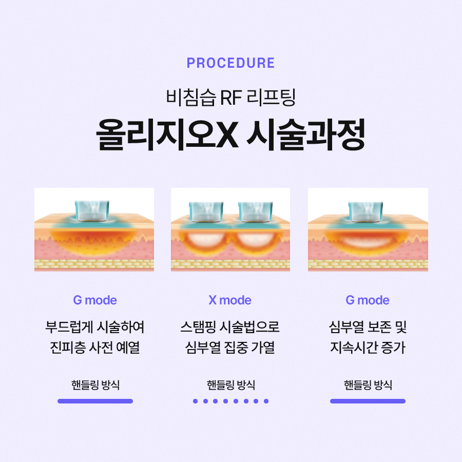 올리지오x 피부 결과 주름 개선 효과를 보고 싶으신가요? 관련 이미지 4