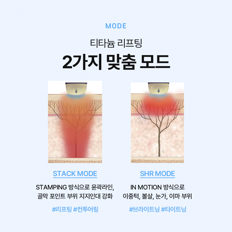 티타늄리프팅 효과와 장점, 유지 기간 및 주의사항에 대해 관련 이미지 3