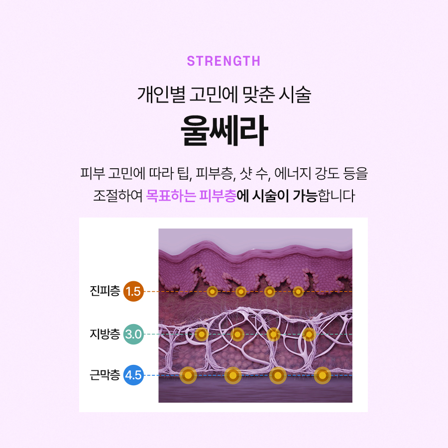 울쎄라리프팅 효과와 시술 과정에 대해 관련 이미지 5
