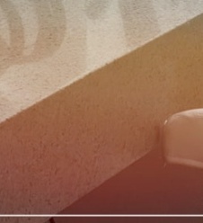 울쎄라프라임 리프팅 효과와 적용 부위에 대해 관련 이미지 26