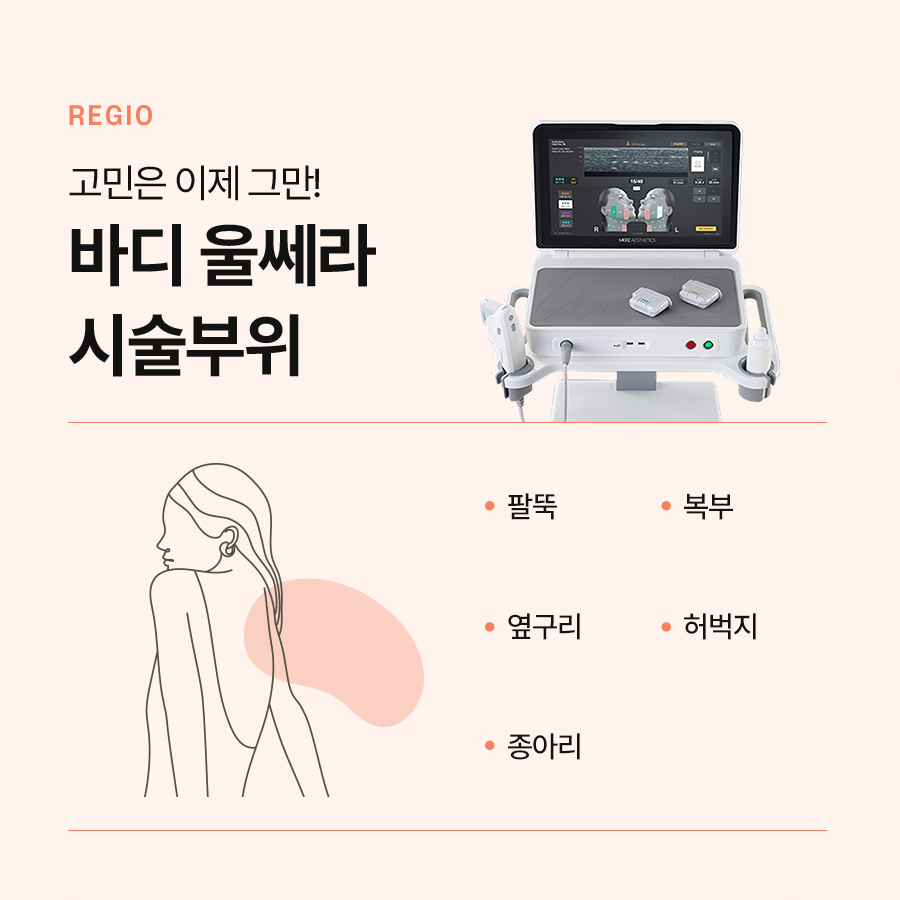 Body Ulthera Lifting for Concerns About Sagging Skin image 5