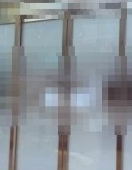 If You’re Looking Into Body Shurink’s Effects and the Areas It Can Be Applied To image 13