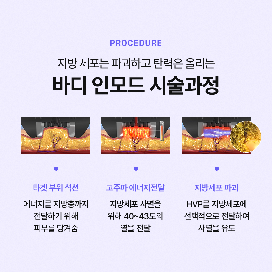 바디인모드 효과가 궁금하시다면 관련 이미지 4