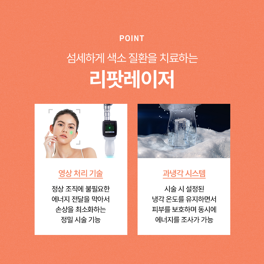 리팟레이저 얼굴흑자 치료하고 싶다면 관련 이미지 6