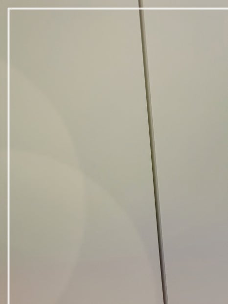온다리프팅 효과 통증 궁금하다면 관련 이미지 19