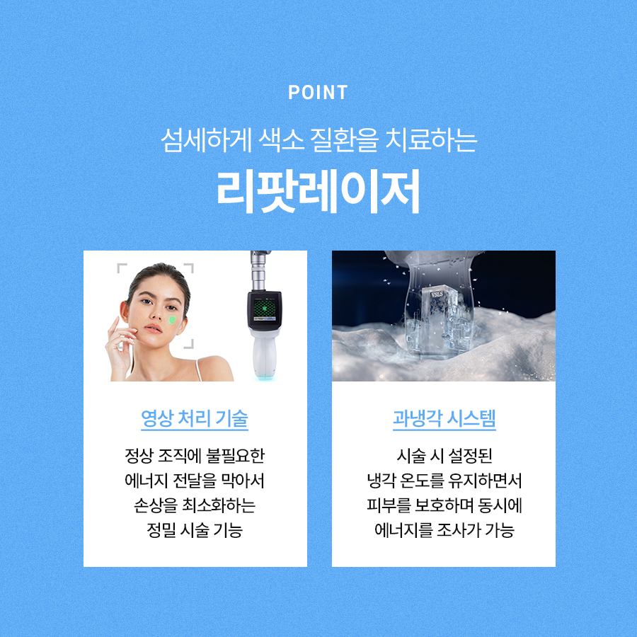 리팟레이저 얼굴 흑자 제거 원한다면 관련 이미지 5