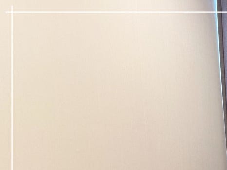 튠바디 시술 효과 확인해보면 관련 이미지 10