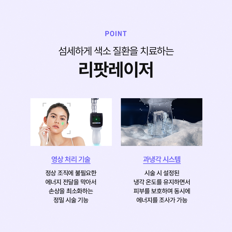 리팟레이저 얼굴 흑자를 효과적으로 제거할 수 있습니다 관련 이미지 4