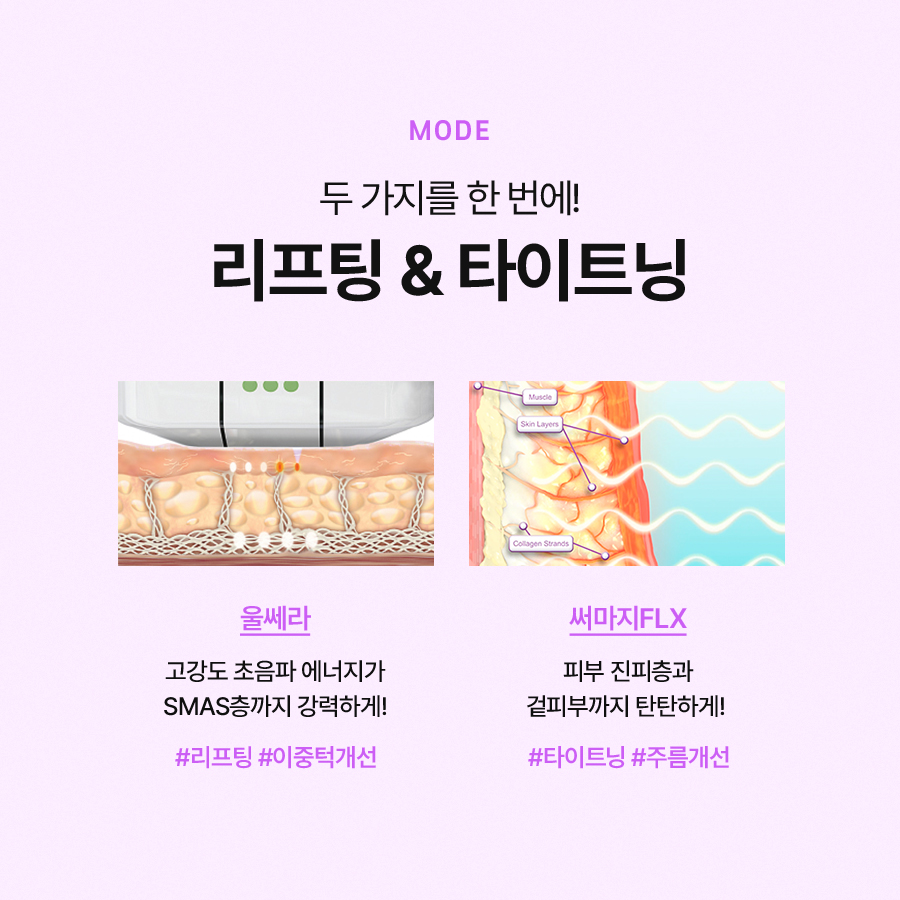 울써마지 리프팅 효과, 통증 알아보면 관련 이미지 4