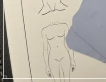 지방분해주사 싹주사 효과적인 체형개선 방법 관련 이미지 25