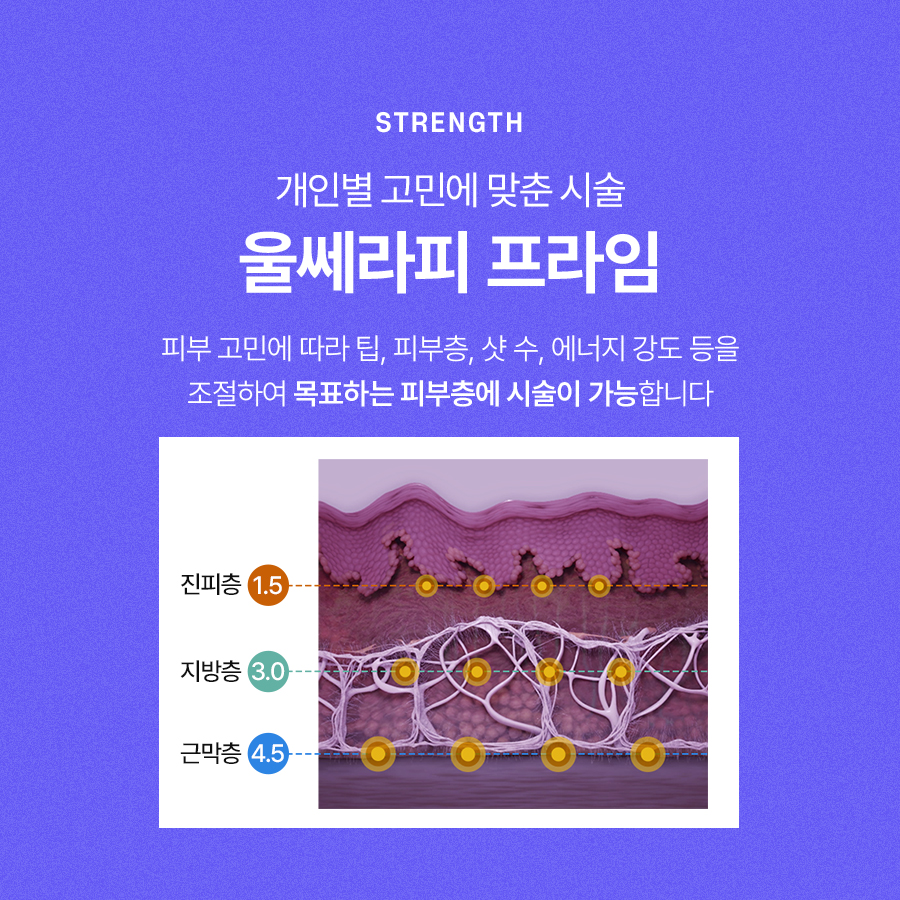 Ulthera 2 for Stronger Lifting Effects image 4